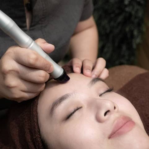 60-Min Hydra Peel Facial (1 Session) at Bio Aesthetic Medispa - Get Deals, Cashback and Rewards with ShopBack GO