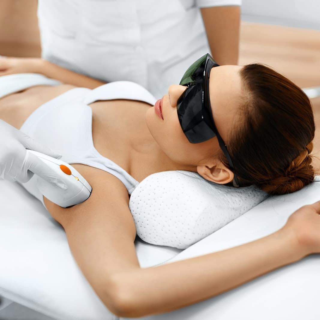OPT Underarm Hair Removal (1 Session)