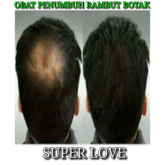 vitamin rambut/penumbuh rambut botak alami herbal